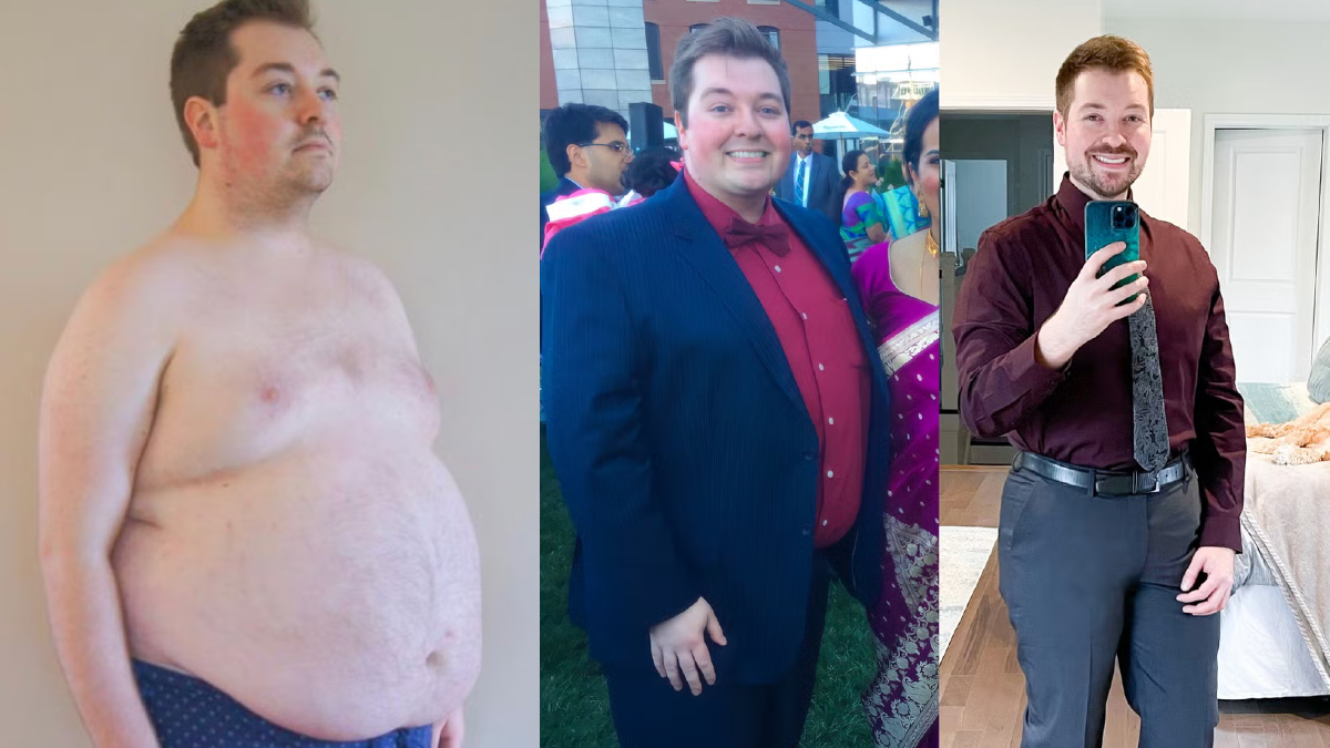 38 साल के डॉक्टर ने घटाया 56 किलो वजन, तनाव में रहने पर ज्यादा खाने की लग गई थी लत, तस्वीर देख नहीं होगा यकीन