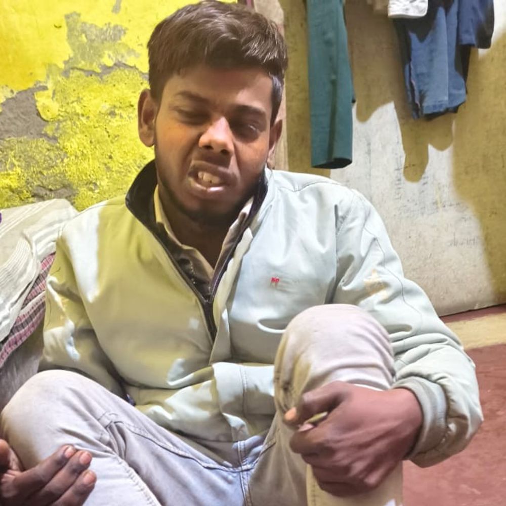 आगरा पुलिस ने दूधिया को बुरी तरह पीटा:पिटाई से अंगूठे का नाखनू उखड़ा, जीवनी मंडी चौकी इंचार्ज सस्पेंड