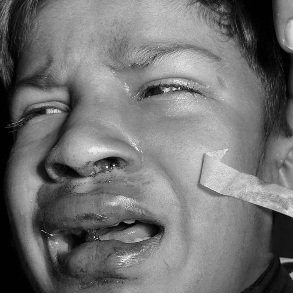 जगराओं में छत से गिरा 10 साल का बच्चा:अकेला उड़ा रहा था पतंग, अचानक फिसला पैर, गंभीर हालत में अस्पताल में भर्ती