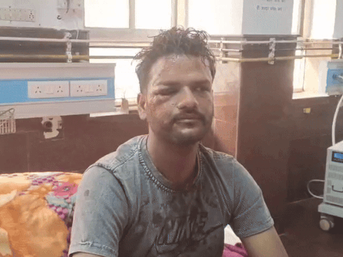 कोटा में पैसे लौटाने के बहाने बुलाकर जमकर की मारपीट:युवक पर लोहे के पाइप डंडों से किया हमला, मेडिकल कॉलेज अस्पताल में भर्ती