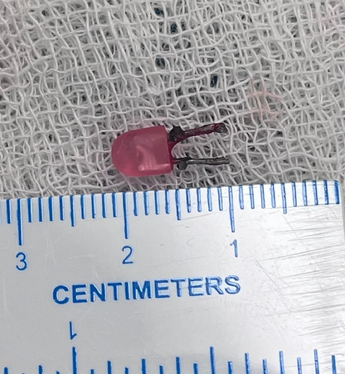 मासूम की सांस नली में फंसा था एलईडी बल्ब, चिकित्सकों ने दिया नया जीवन