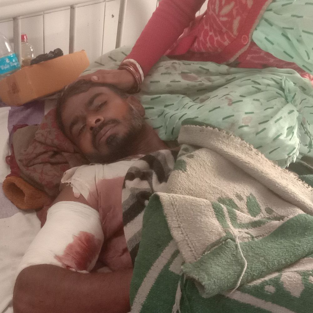 जमीन विवाद में बड़े भाई को छोटे ने मारी गोली:हाथ में लगी बुलेट, भागलपुर रेफर; कट्टा और 16 जिंदा कारतूस बरामद