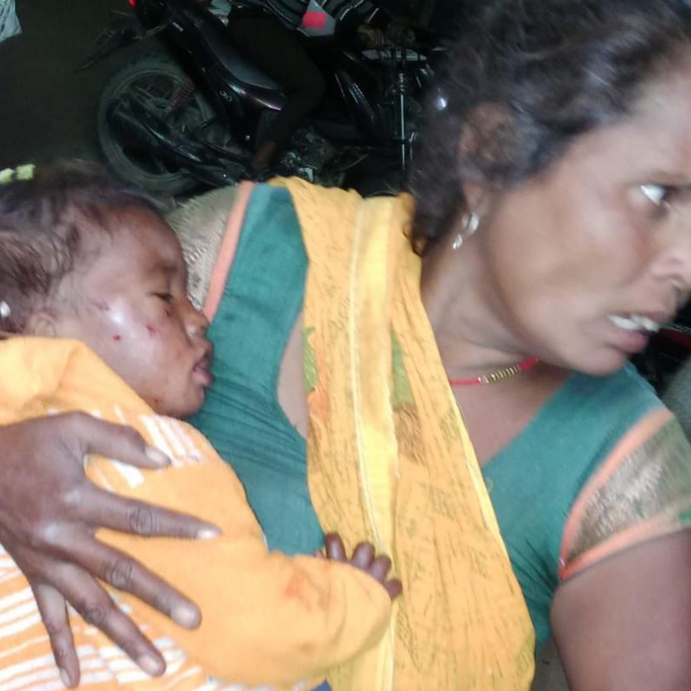 बहराइच में मासूम पर जंगली जानवर का हमला:मां के शोर मचाने पर बची जान, अस्पताल में इलाज