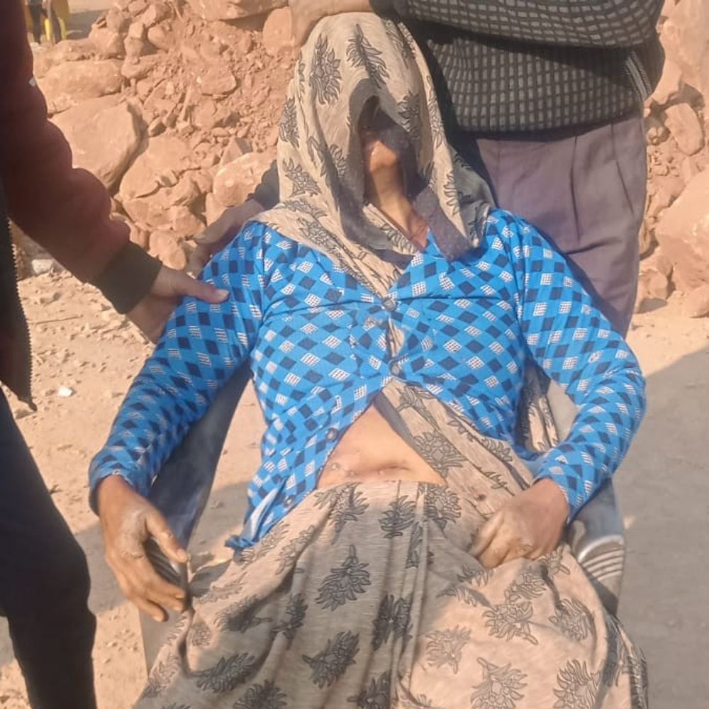 शिकार के लिए बिछाए करंट से महिला झुलसी:सीधी में जंगल से लकड़ी बीनने गई थी, रीवा रेफर