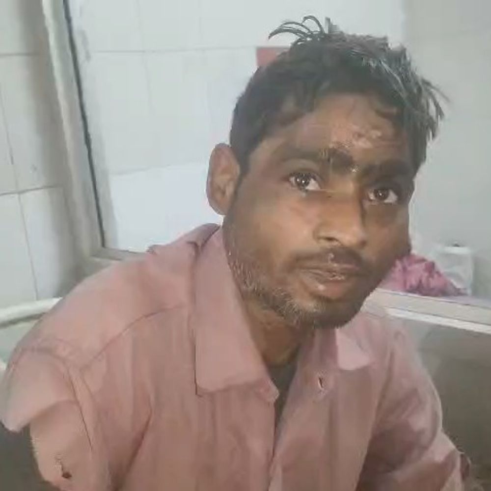 पत्नी से विवाद के बाद युवक ट्रांसफार्मर पर चढ़ा:करंट लगने से झुलसा, गंभीर हालत में अस्पताल में भर्ती