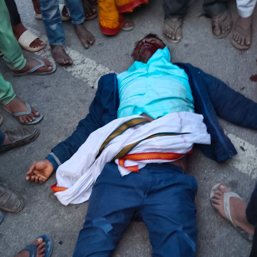 रोहतास में अज्ञात वाहन की टक्कर से व्यक्ति गंभीर घायल:एक घंटे तक सड़क पर तड़पता रहा, सूचना पर पुलिस ने अस्पताल में कराया एडमिट