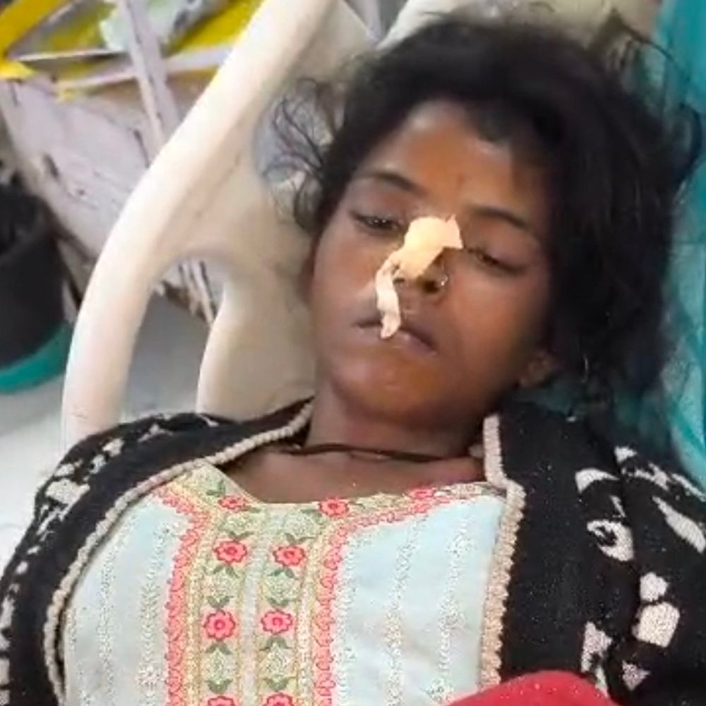 अग्रोहा मेडिकल में 5 दिनों से मां कोमा में:पास बैठा मासूम इंतजार में; परिजनों का पता नहीं, हादसे के बाद पुलिस लाई थी