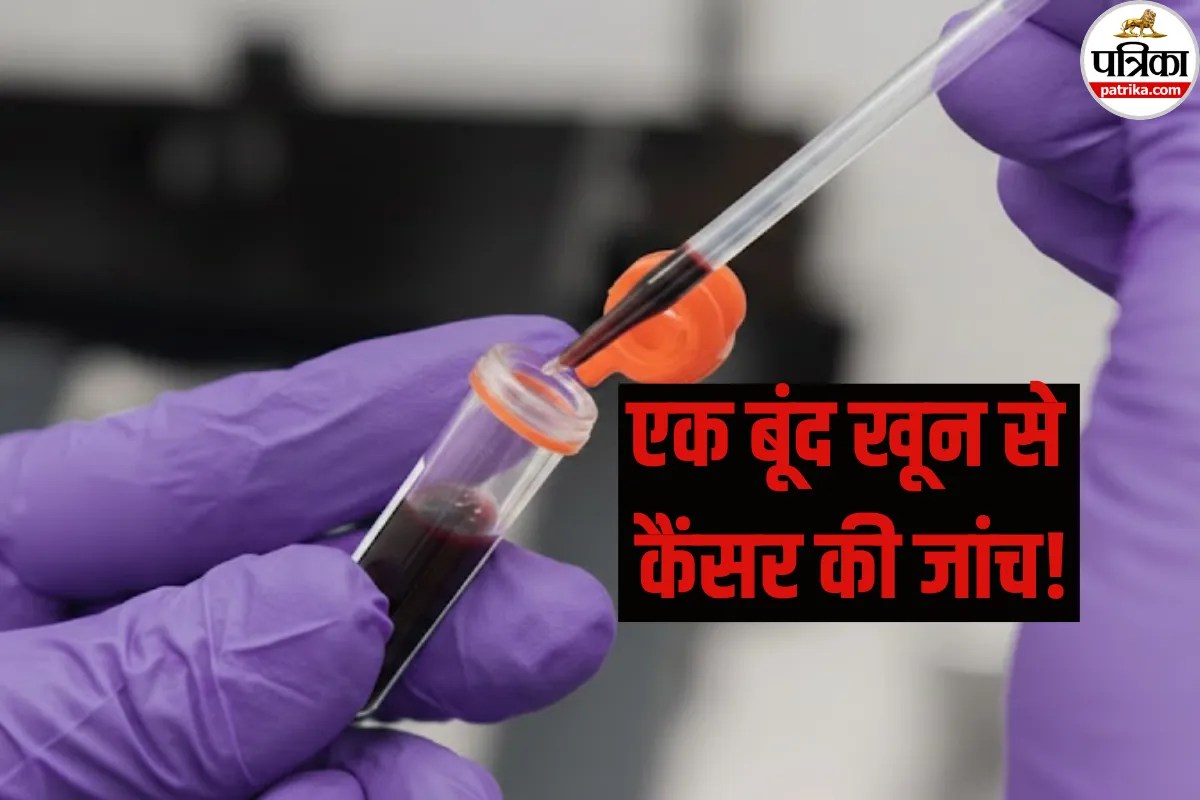 World Cancer Day 2026: दर्दनाक बायोप्सी को कहें अलविदा! एक बूंद खून से होगी कैंसर की जांच, अभी जानें क्या होती है Liquid Biopsy