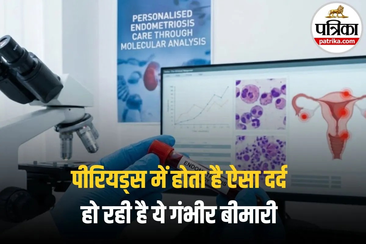 Endometriosis Symptoms: 30 की उम्र के बाद बढ़ सकती है मुश्किल! अगर पीरियड्स में होता है ऐसा दर्द, तो तुरंत कराएं ये जांच