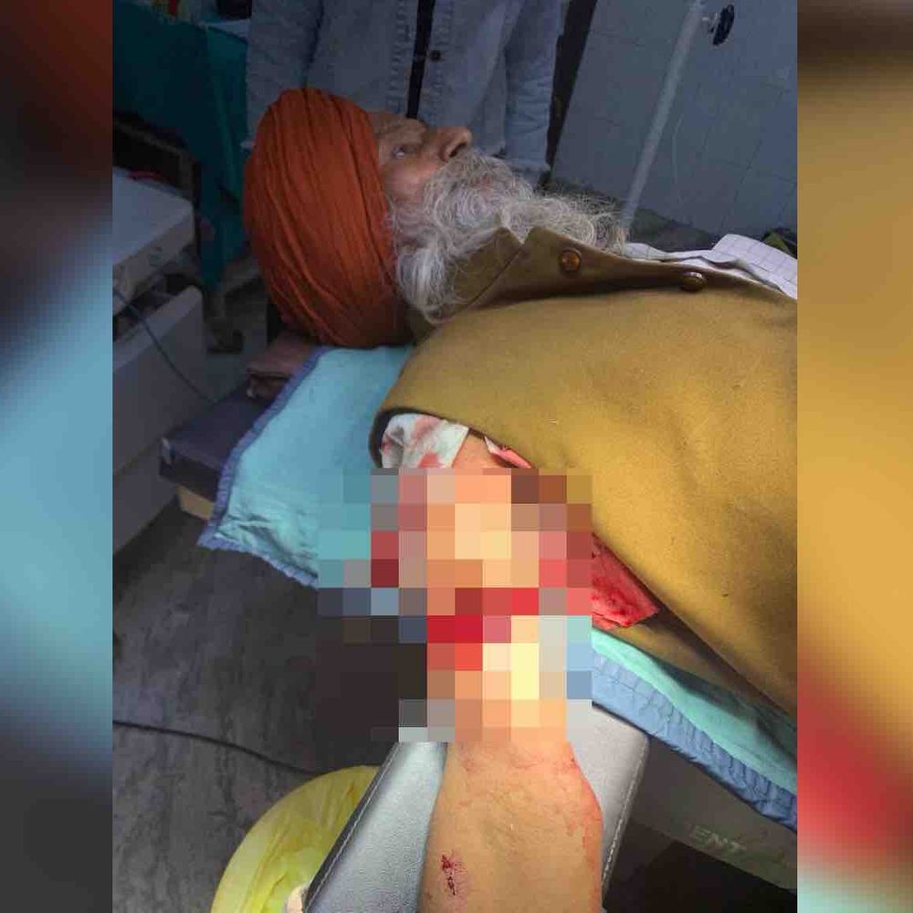 रोपड़ में चाइना डोर से बुजुर्ग व्यक्ति की बाजू कटी:गंभीर रूप से घायल, बाइक चलाते समय हुआ हादसा, इलाज जारी