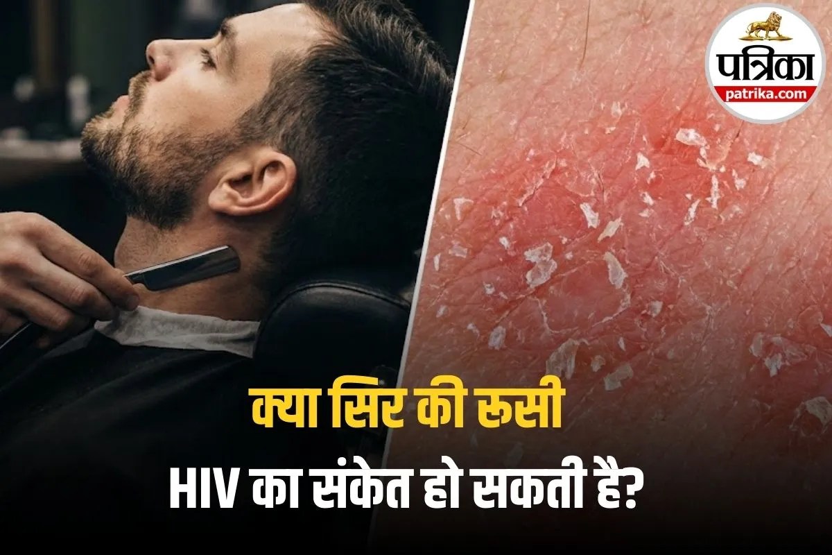 HIV Skin Symptoms: डैंड्रफ या खतरनाक संकेत? जानिए कब रूसी बन सकती है गंभीर बीमारी