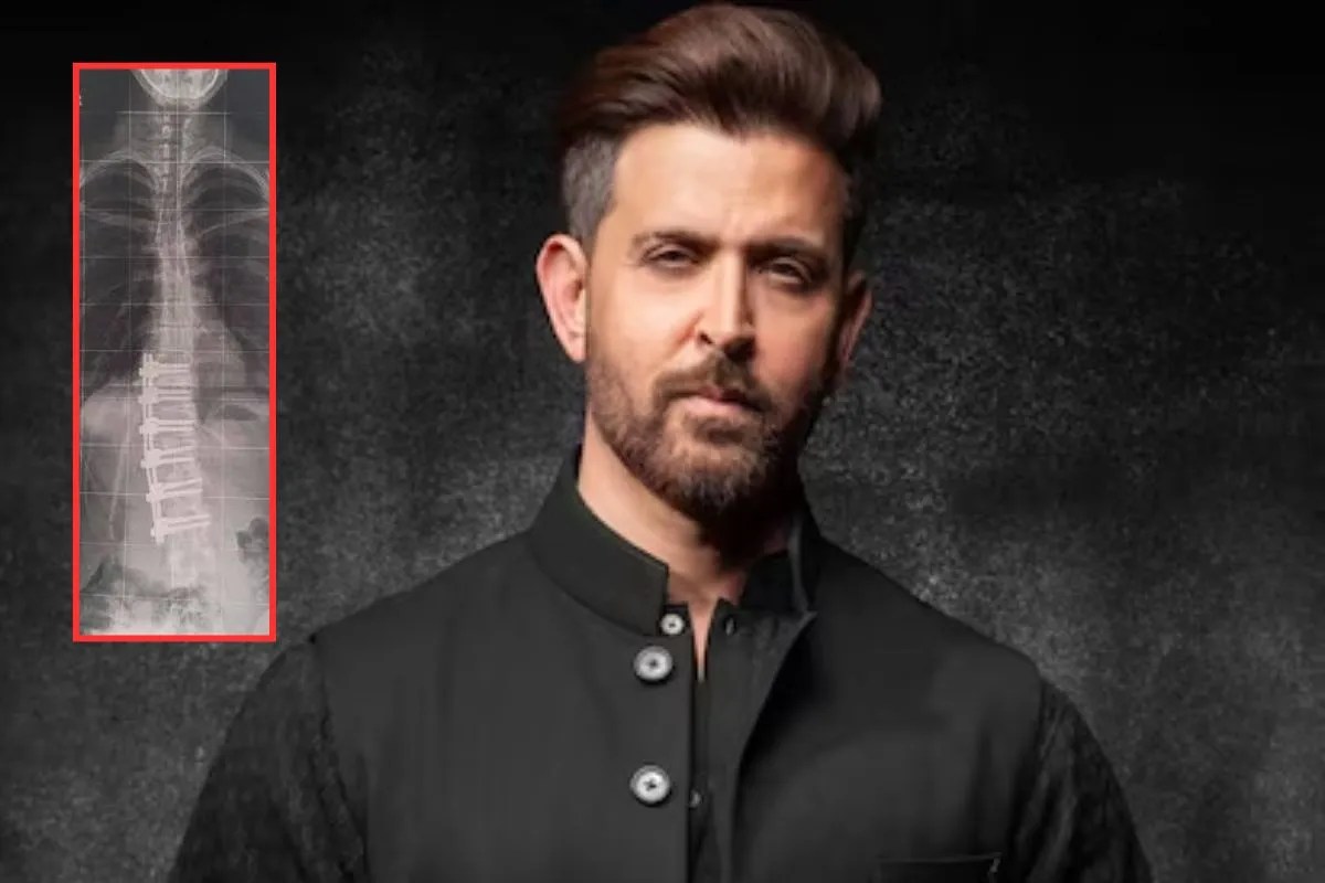 ऋतिक रोशन ने किया था बड़ी शारीरिक चुनौती का सामना, डॉक्टर्स ने दी थी ये चेतावनी