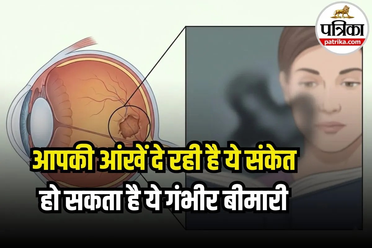 Macular Degeneration: सामने दिखता चेहरा… लेकिन पहचान नहीं पा रहे? हो सकता है ये गंभीर बीमारी