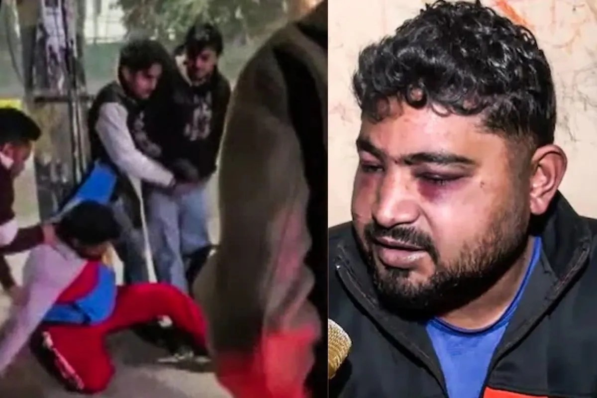 आजकल किसी को बचाना भी गुनाह…महिलाओं को बचाने में घायल युवक की मां का छलका दर्द