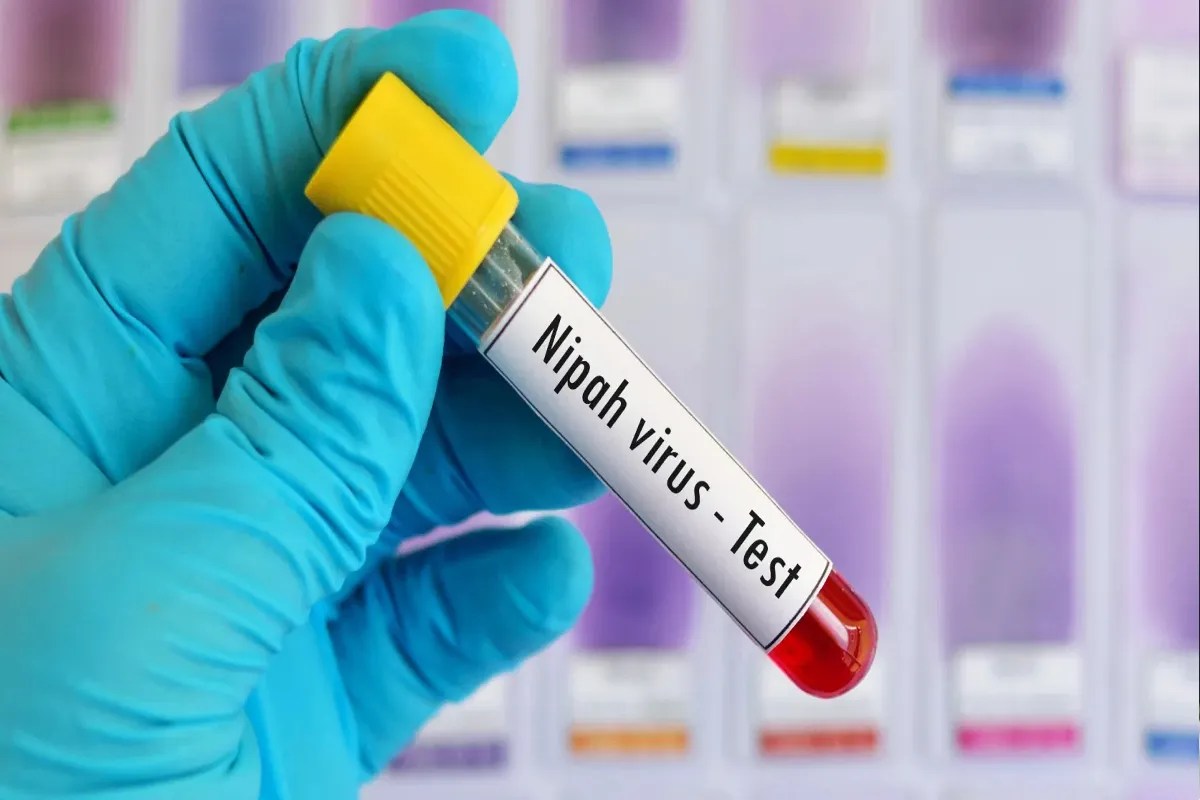 पश्चिम बंगाल में निपाह वायरस से पहली मौत: कैसे फैलता है यह वायरल? जानें इसके लक्षण