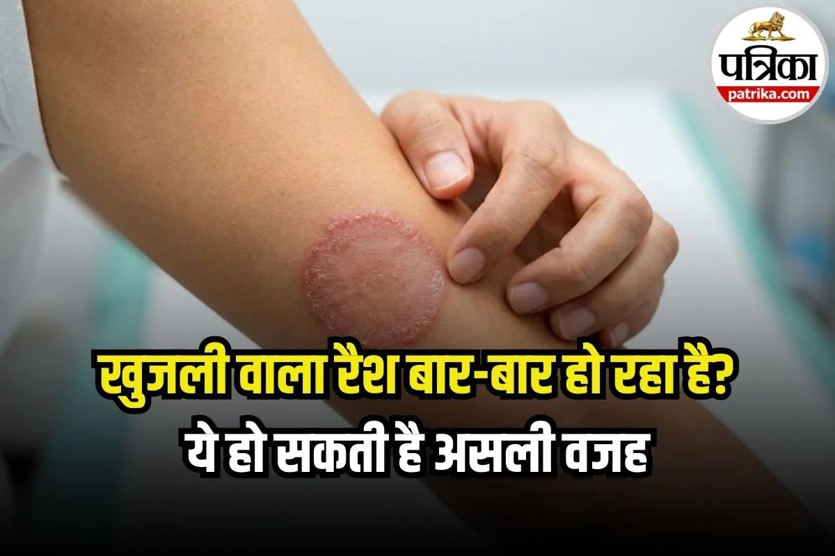 Tinea Fungal Infection Symptoms: त्वचा पर गोल लाल खुजली वाला दाग? हो सकता है फंगल इंफेक्शन टिनिया, जानिए लक्षण और इलाज