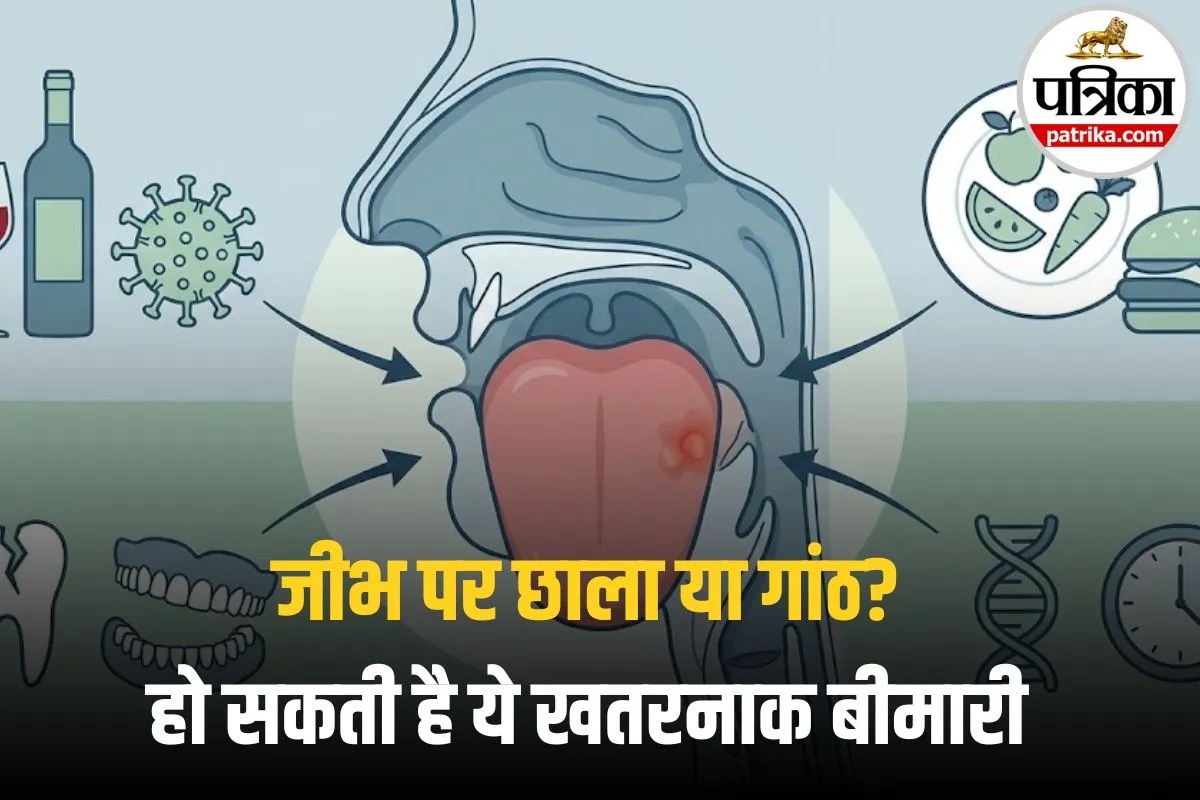Tongue Cancer Causes: जीभ पर सफेद दाग या निगलने में दर्द? सावधान! कहीं ये कैंसर की शुरुआत तो नहीं
