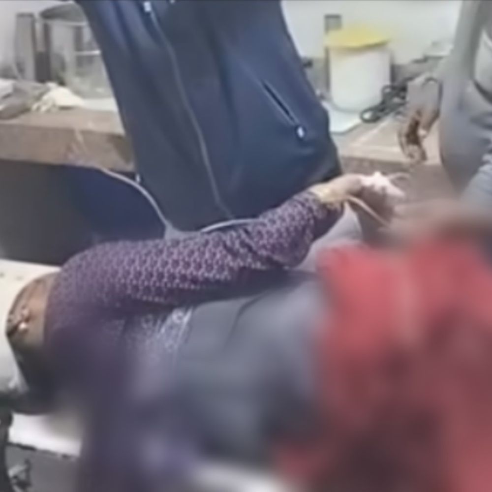 जोकीहाट में पुरानी रंजिश को लेकर मारपीट:मामूली कहासुनी में लाठी-डंडों से पीटने का आरोप, एक महिला घायल; सीएचसी में भर्ती