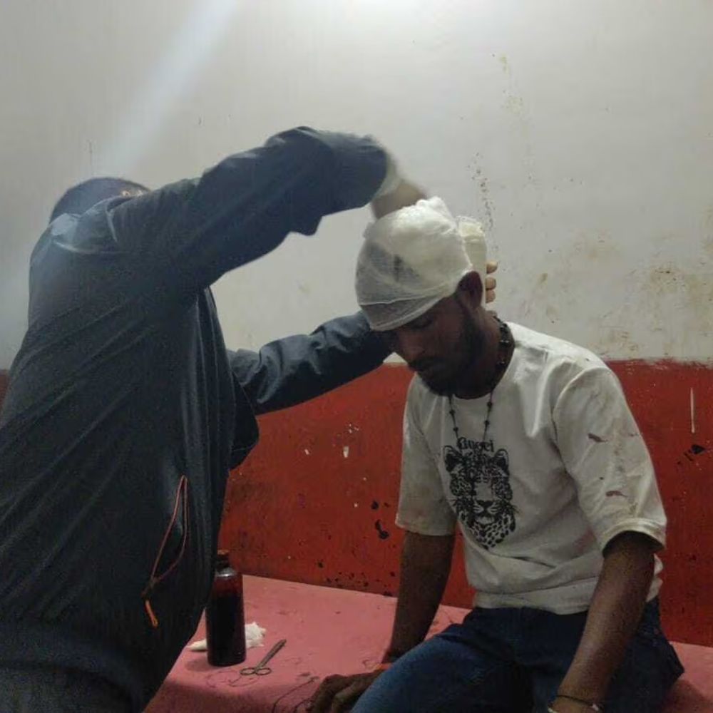 अमरपुर में दो बाइकों की आमने-सामने टक्कर:बाइक सवार दंपती सहित 5 घायल, सिहुड़ी मोड़ पर हादसा