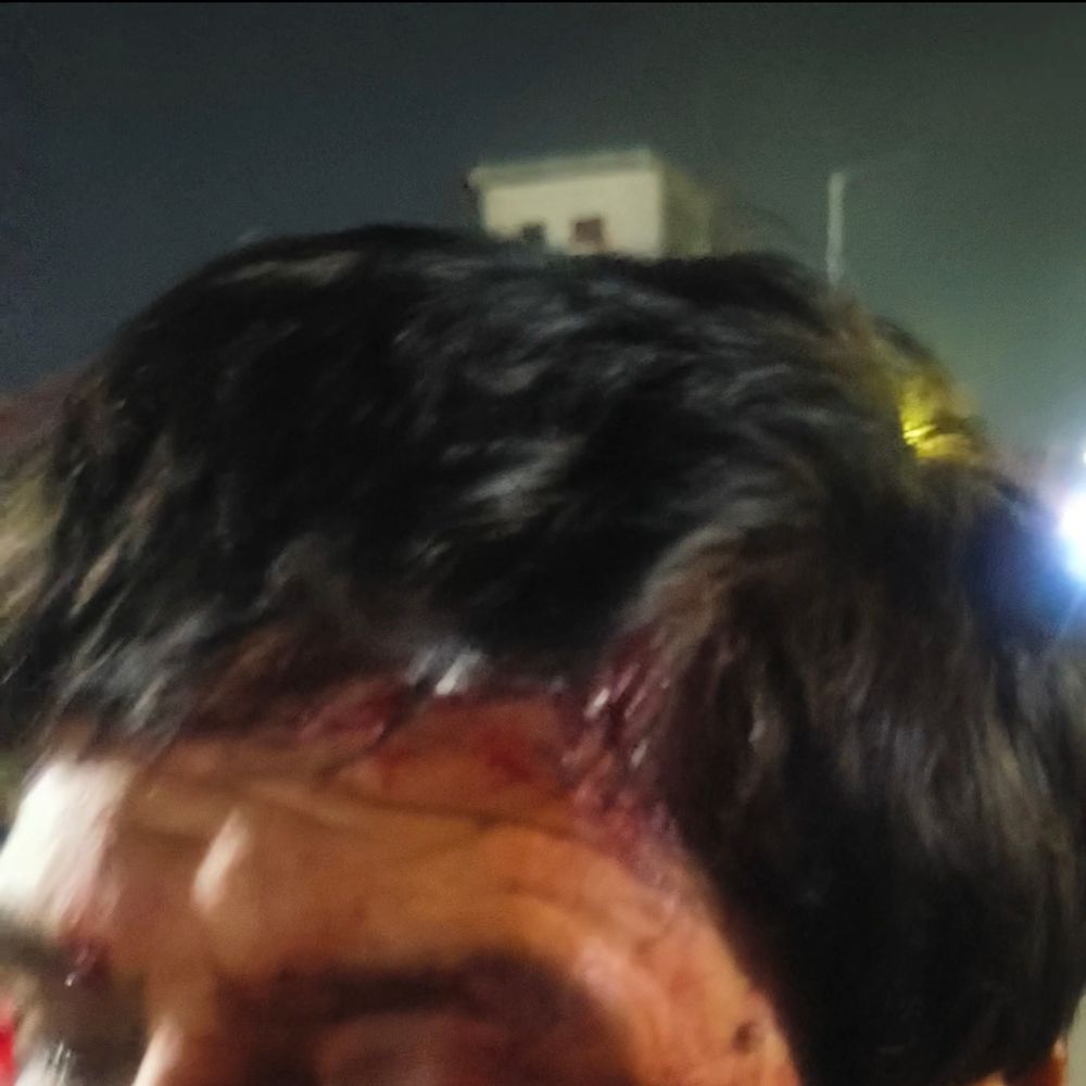 पैग लगाने से मना किया… सब्जी मंडी में सिक्योरिटी गार्ड का सिर फोड़ा