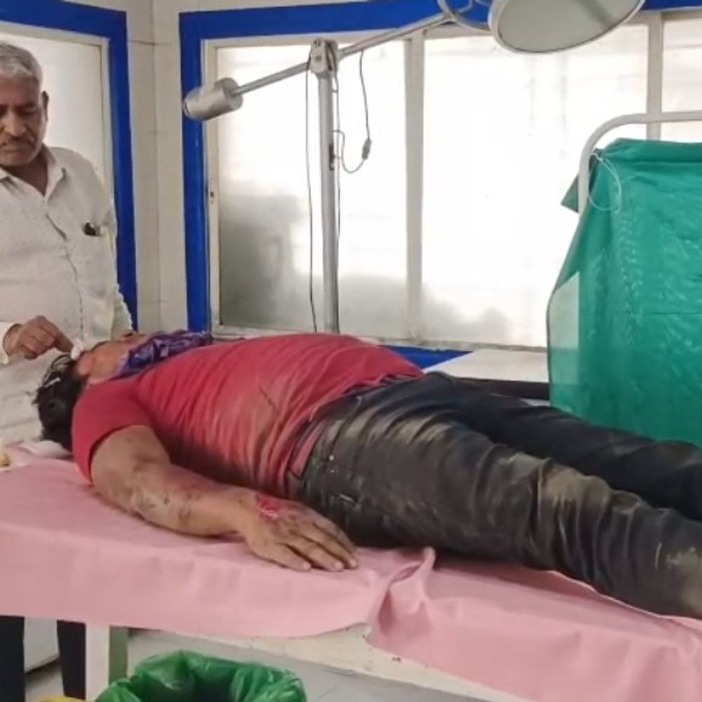 देवास में अज्ञात वाहन ने बाइक को टक्कर मारी:दो घायल, एक की हालत गंभीर; एमजी अस्पताल में इलाज जारी