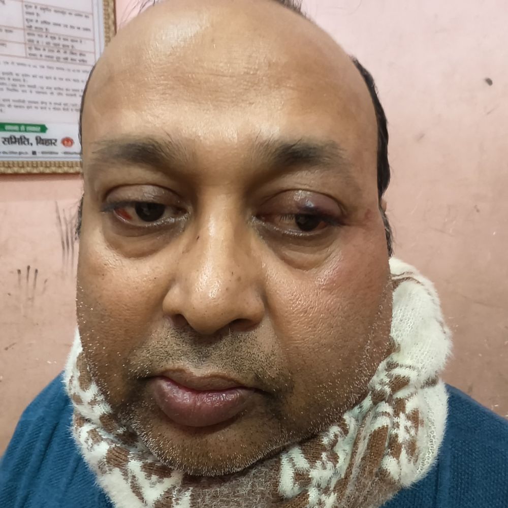 दरभंगा के कुशेश्वरस्थान थानाध्यक्ष पर मारपीट का आरोप:SSP से शिकायत, पीड़ित बोला- थाने में मारपीट और गाली-गलौज की गई, जेल भेजने की दी धमकी