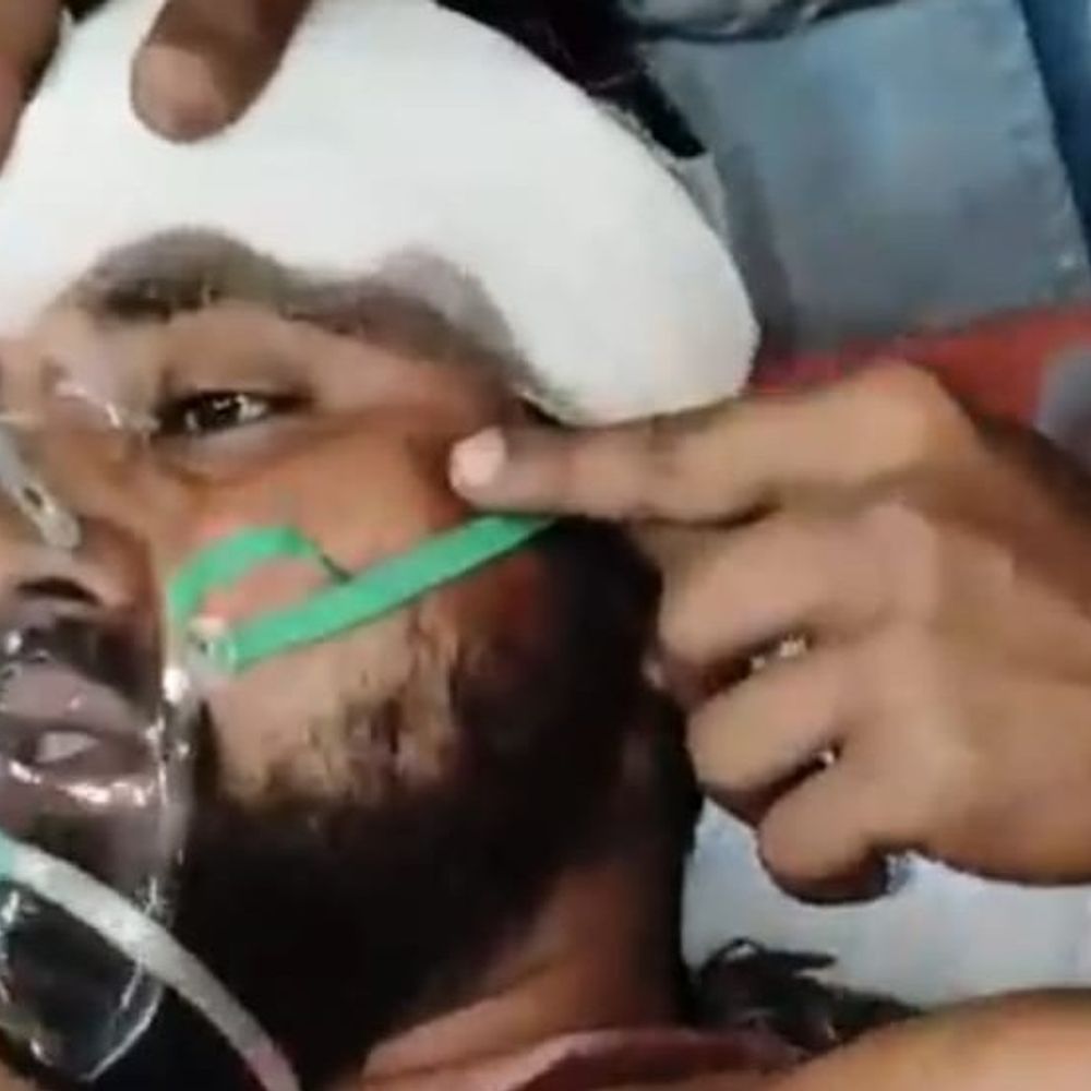 छपकी मोहल्ले में युवक पर चाकू से हमला, गंभीर घायल:6 से अधिक जगहों पर वार किया, डीएमसीएच में भर्ती; मामला दर्ज