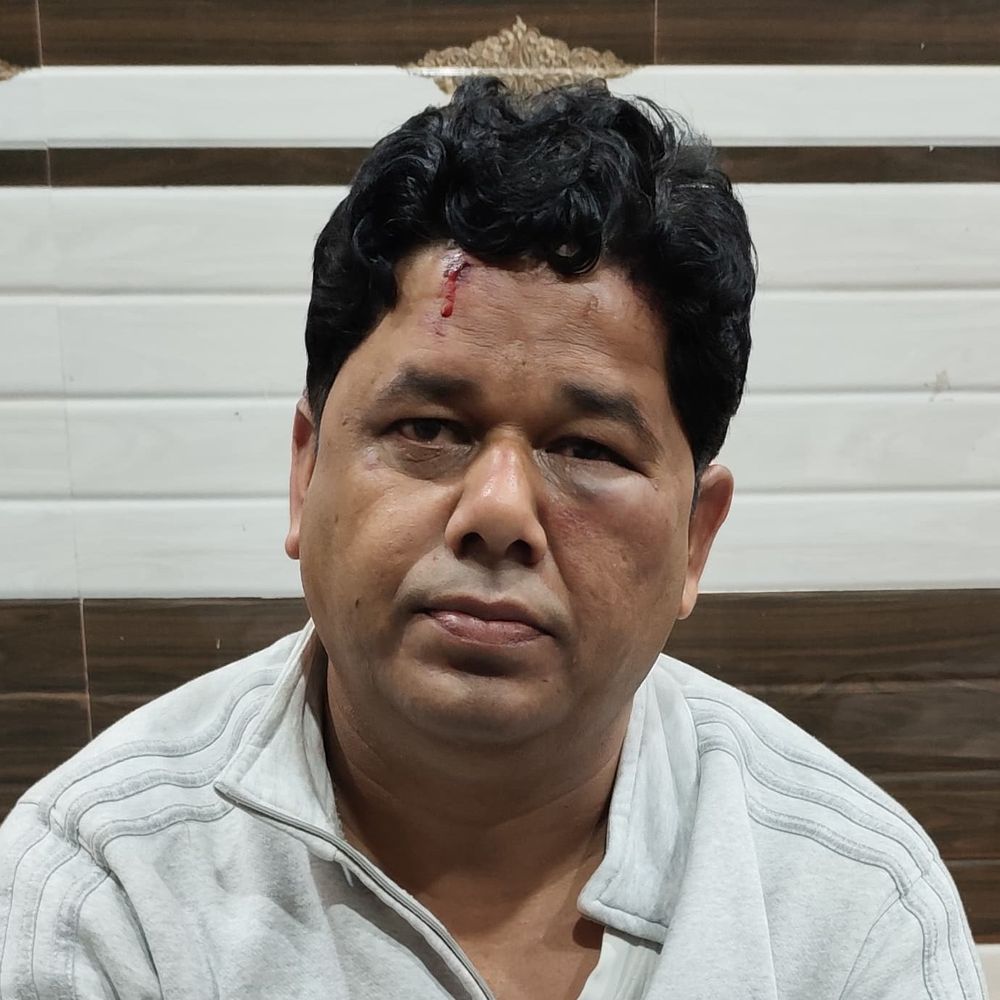 हिस्ट्रीशीटर ने घर में घुसकर व्यापारी को तमंचे से पीटा:20 लाख की रंगदारी मांग रहा था, आरोपी पर 50 से ज्यादा मुकदमें हैं दर्ज