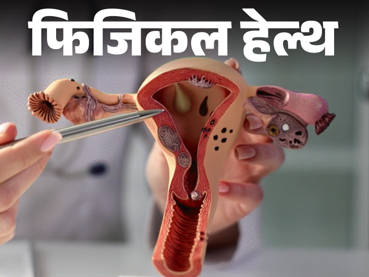 फिजिकल हेल्थ- बार–बार हैवी पीरियड्स:हो सकता है यूटेरिन फाइब्रॉइड, डॉक्टर से जानें ये क्या है, इन 12 लक्षणों को इग्नोर न करें