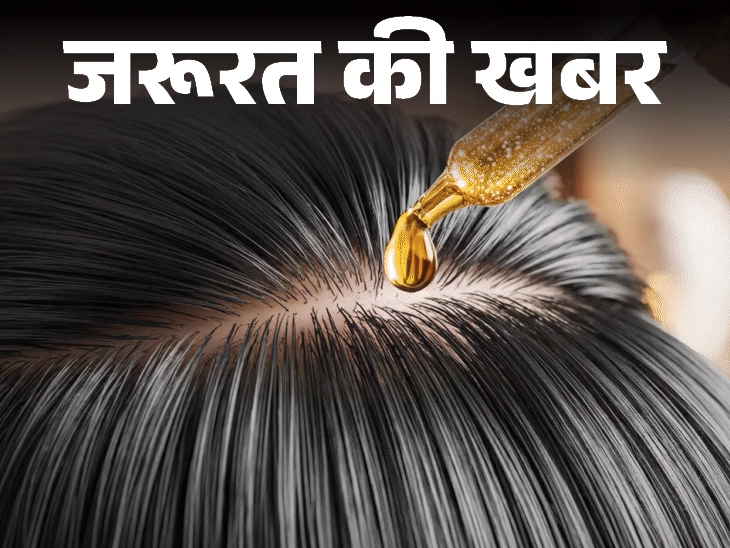जरूरत की खबर- क्या बालों में ऑयलिंग से बढ़ता डैंड्रफ:क्या है सही तरीका, हेयर प्रोटेक्शन के 12 टिप्स, बता रहे हैं डर्मेटोलॉजिस्ट