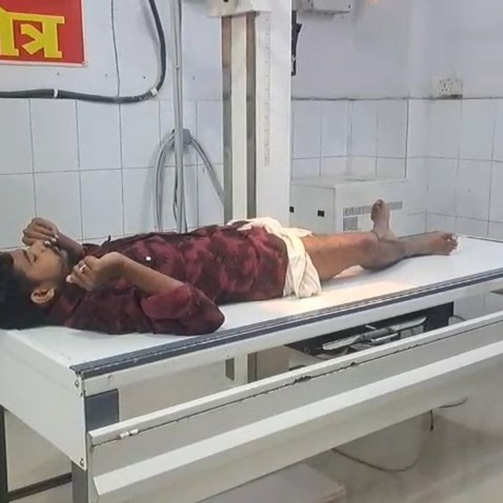 जमुई में युवक ने थाने में टॉर्चर का लगाया आरोप:पीड़ित बोले- प्रेम प्रसंग में जबरदस्ती शादी का बनाया दबाव, एसपी से शिकायत दर्ज कराई