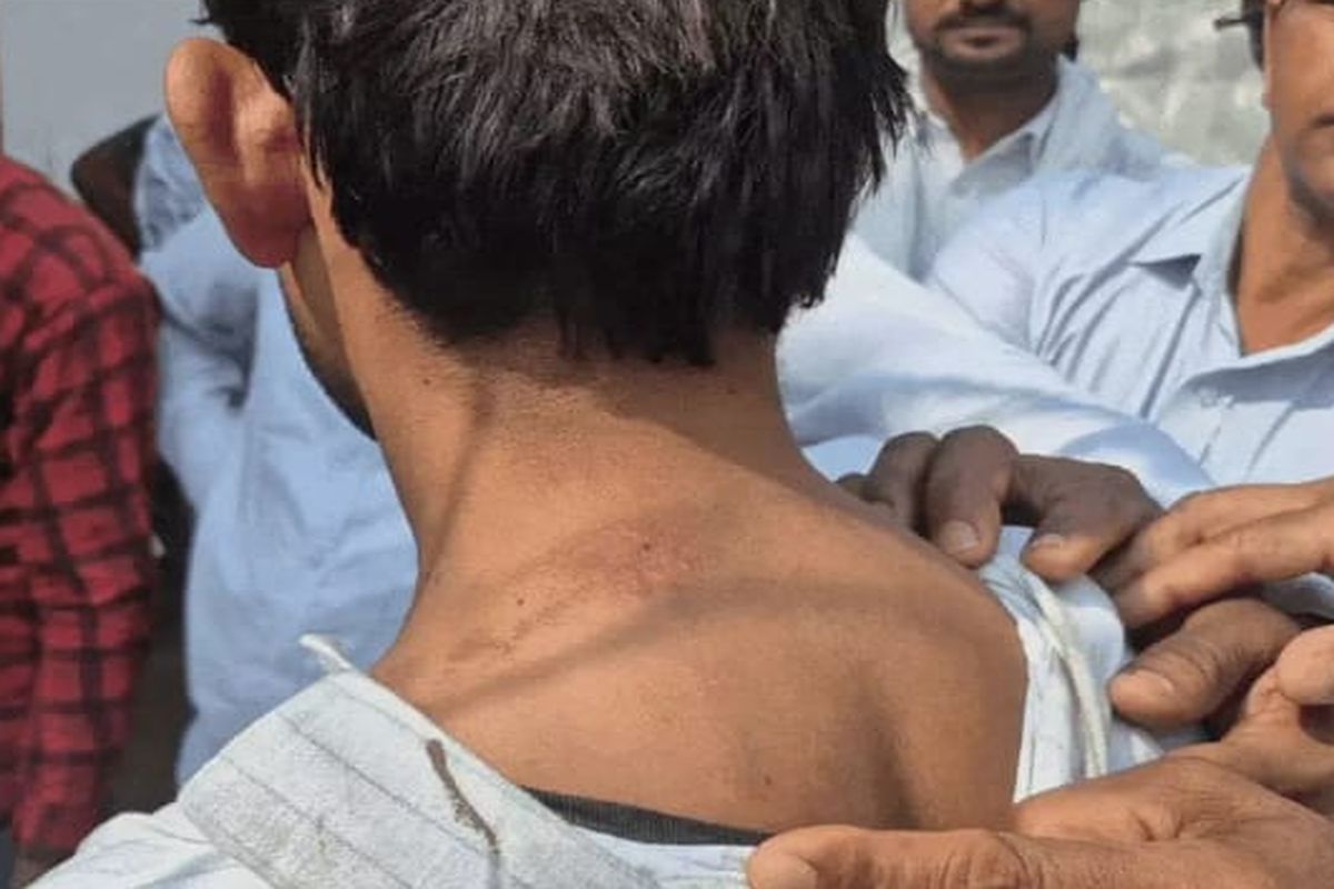 Jhunjhununews : दिनदहाड़े ऑटो ड्राइवर व साथियों ने बस कंडक्टर को पीटा, यूनियन में उबाल