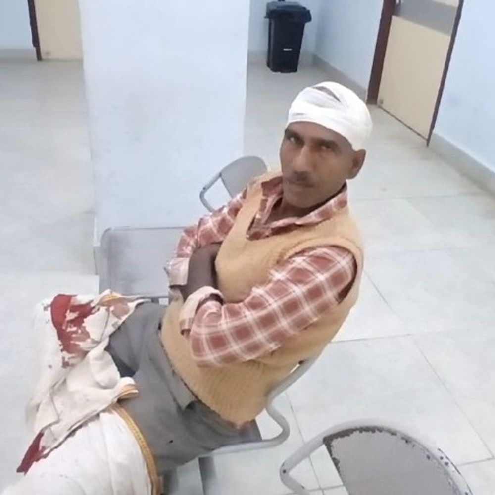 गोपालगंज में जमीन विवाद में 2 पक्षों में मारपीट:4 लोग घायल, मॉडल सदर अस्पताल में इलाज जारी