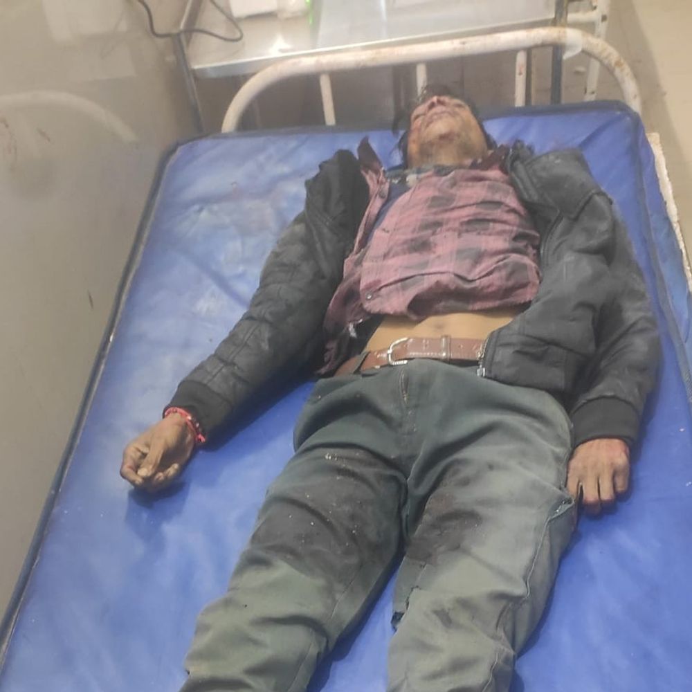 शिवपुरी में ट्रक की टक्कर से एक की मौत:बाइक सवार और राहगीर घायल, कुल्हाड़ी गांव के पास हादसा