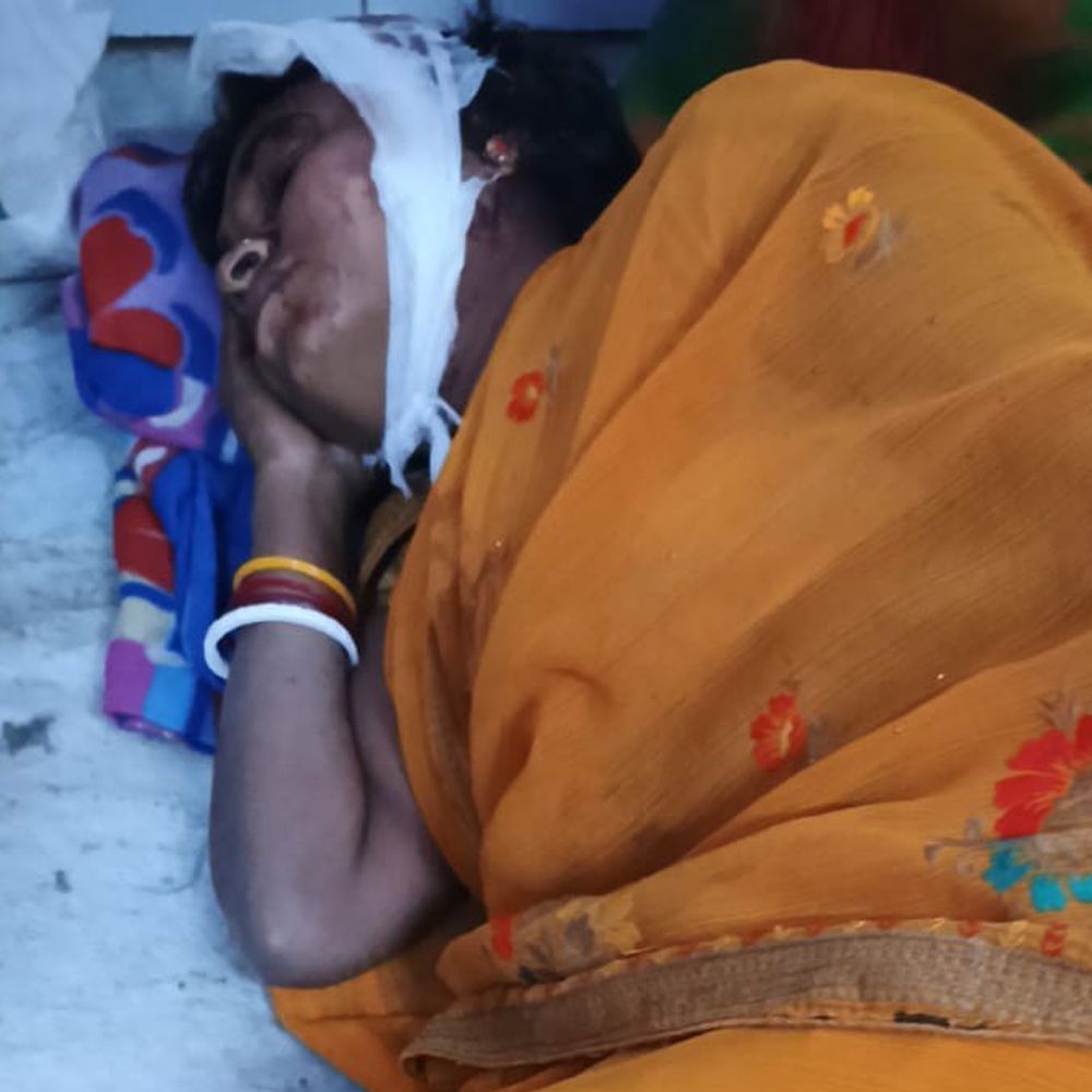 मुंगेर में दो पक्षों में मारपीट, दंपती जख्मी:एक कट्ठा जमीन के लिए पाटीदार ने किया हमला; ईंट रखने से मना करने पर लाठी-डंडों से पीटा