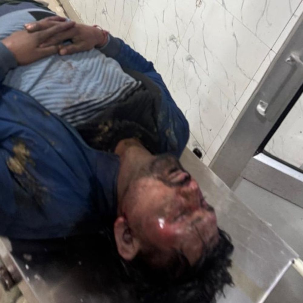 लखनऊ में वकील का अपहरण कर बेरहमी से पिटाई:मरा समझकर रेलवे ट्रैक किनारे फेंका, गाड़ी लड़ने से विवाद शुरू हुआ