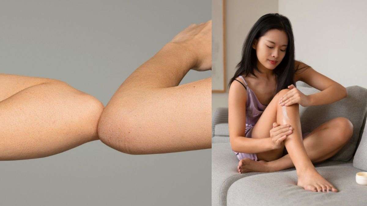 घुटने और कोहनी का कालापन झट से होगा गायब, बस इन घरेलू उपायों को करें फॉलो