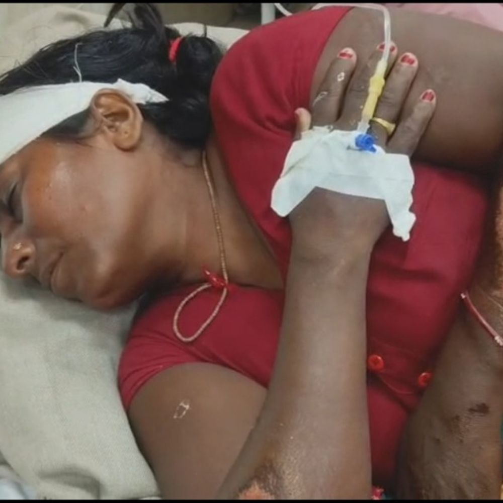 गायघाट में महिला के साथ चैन स्नेचिंग का मामला:इलाज कराकर लौटते समय हुई घटना, बाइक भी पलटी