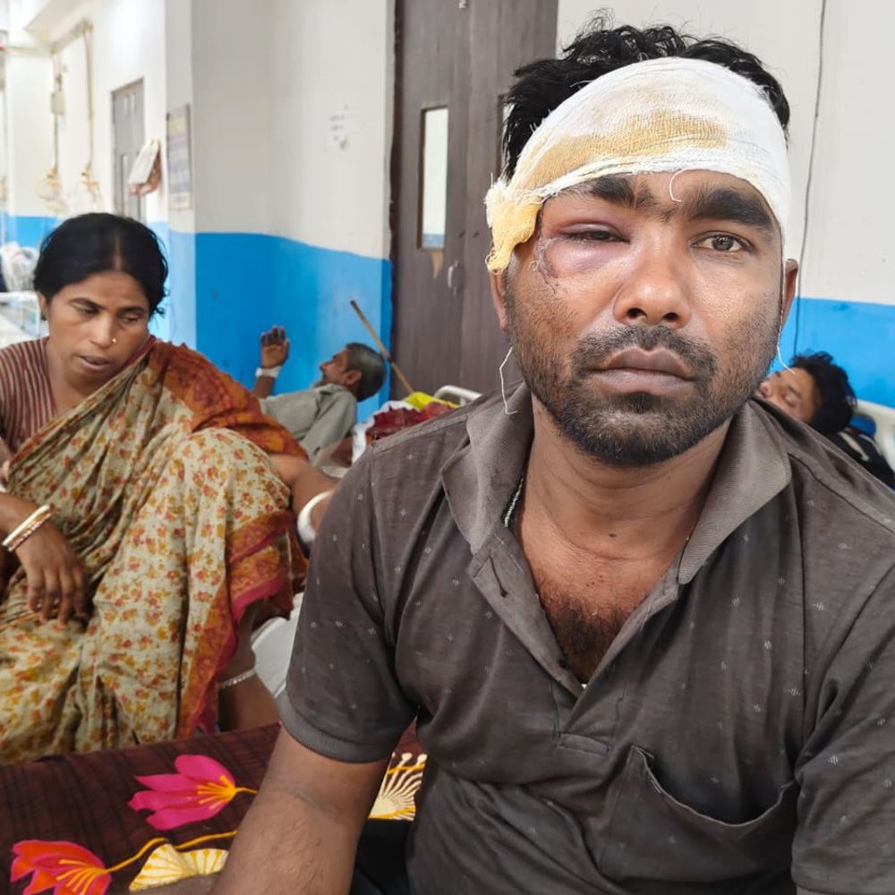 सहरसा में टांट विवाद पर बवाल:युवक- पत्नी से मारपीट, चौकीदार समेत कई पर आरोप, एक आंख में गंभीर चोट, पुलिस जांच शुरू