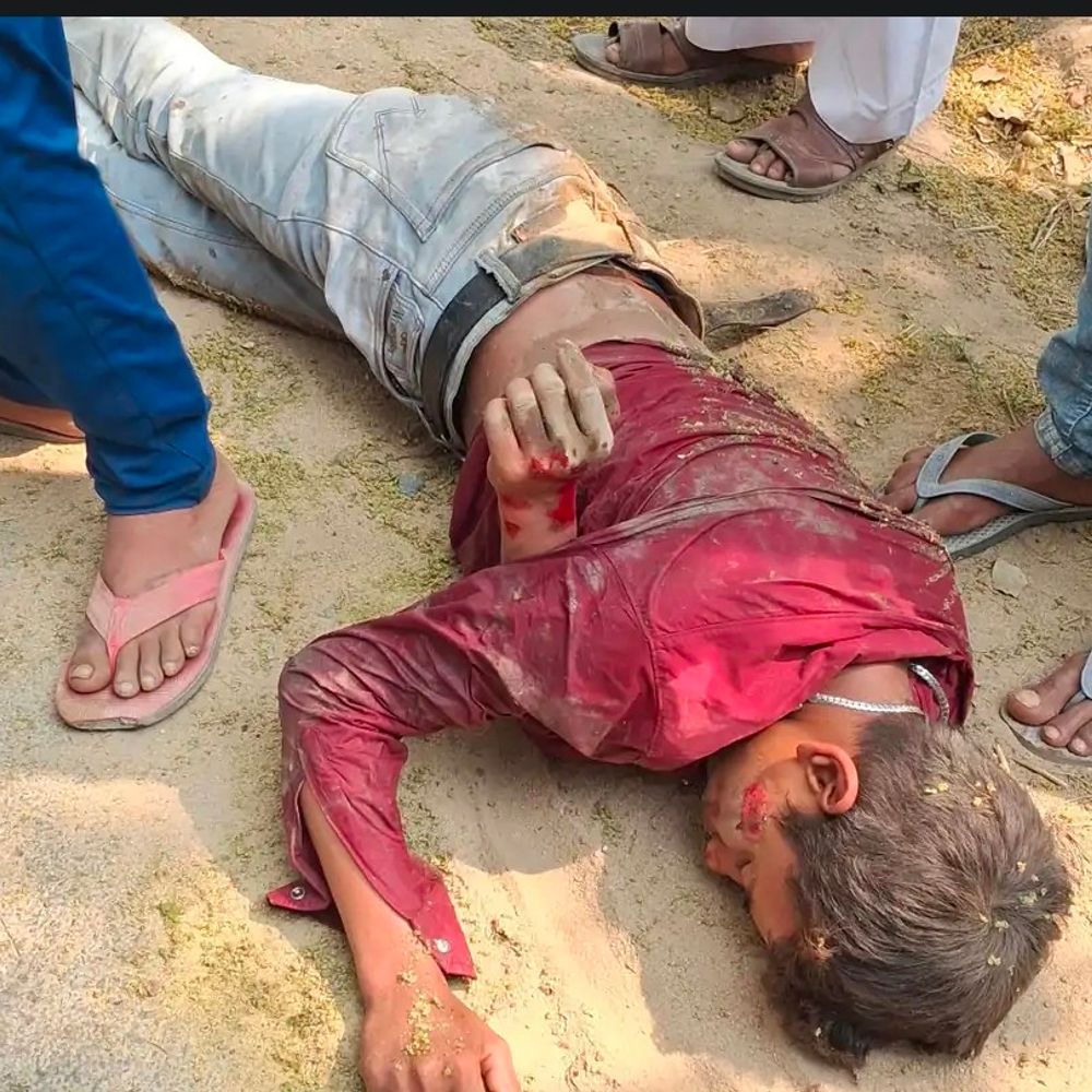 सिद्धार्थनगर में सड़क हादसे में घायल किशोर की मौत:बांसी-धानी मार्ग पर कार-बाइक की आमने-सामने टक्कर, इलाज के दौरान गई जान