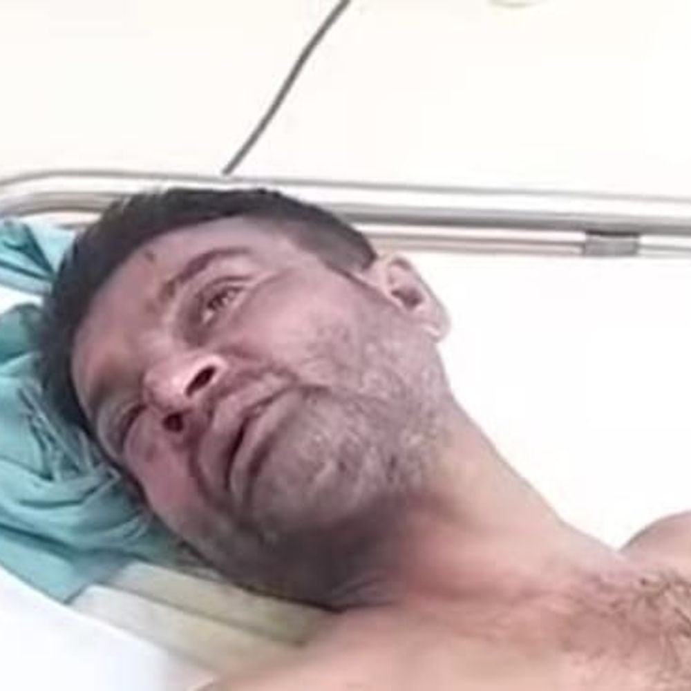 मधुबनी में दो गुटों में झड़प, युवक घायल:हुसैनपुर पंचायत में आपसी विवाद के बाद मारपीट