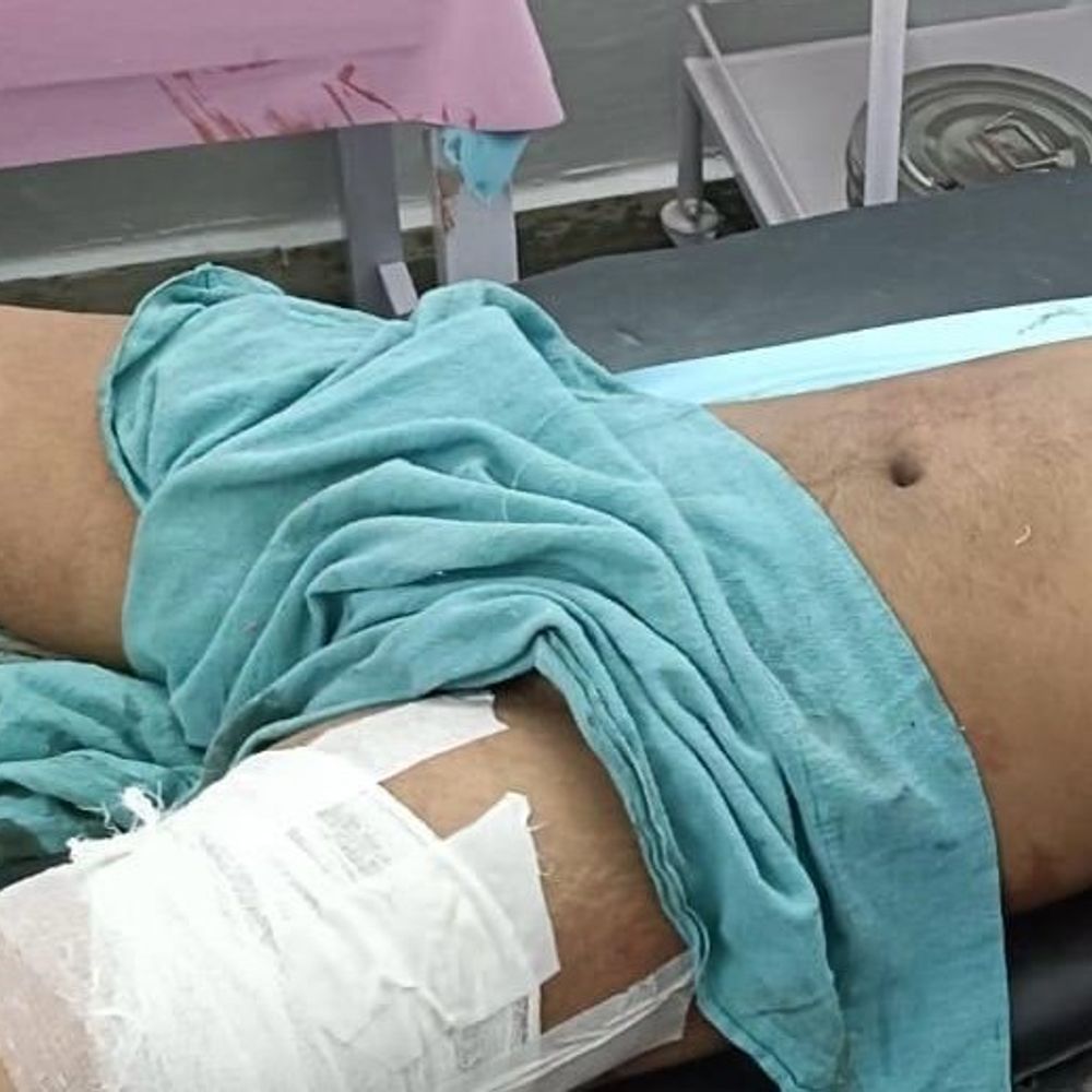 बिहार-मधुबनी के युवक की कटनी में हत्या:सड़क पर थूंकने पर हुआ विवाद, नाबालिग से चाकू से किए वार