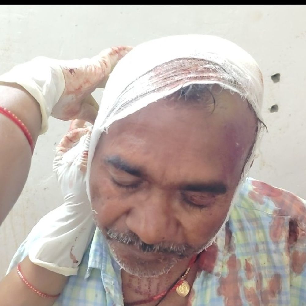 तिलक समारोह में हर्ष फायरिंग, दो को लगी गोली:शकूराबाद के हसनपुरा गांव का है मामला, पुलिस मौके पर पहुंच जांच कर रही