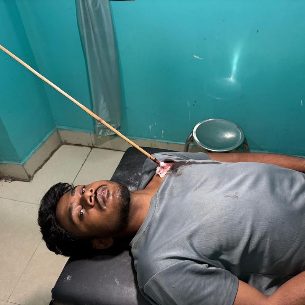 धनबाद में जमीन विवाद में खूनी झड़प:आपसी कहासुनी विवाद में बदली, युवक के सीने में मारा तीर, बेहतर इलाज के लिए रिम्स रेफर