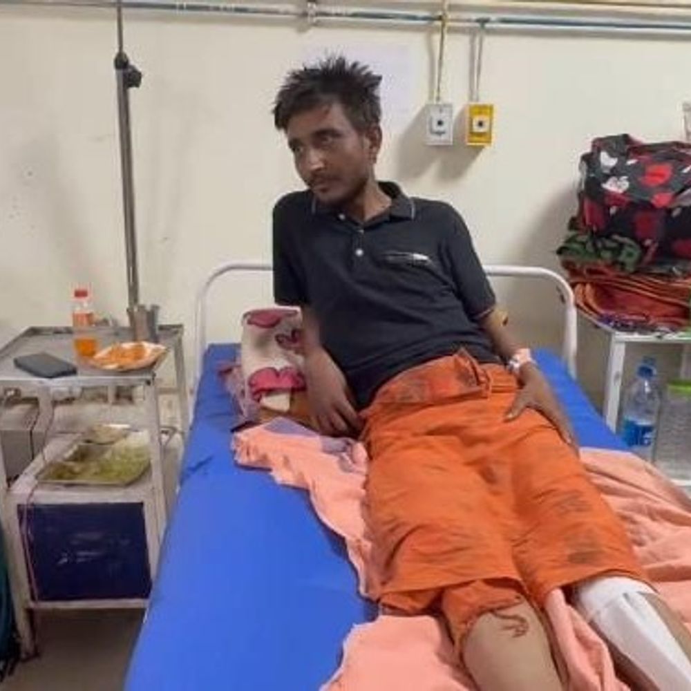 कोरबा पुलिस पिटाई से युवक की जांघ की हड्डी टूटी:कोरबा में पिता के मामले की जानकारी लेने गया था, एसपी ने दिए जांच के आदेश