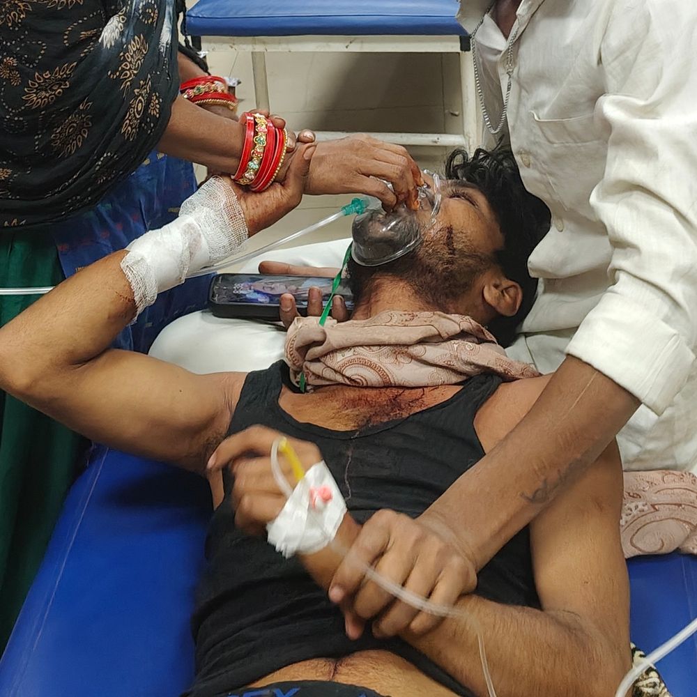 हाथरस में युवक ने काटी हाथ और गर्दन की नसें:पत्नी से चल रहा विवाद, गंभीर हालत में भर्ती, डेढ़ साल पहले हुई थी शादी