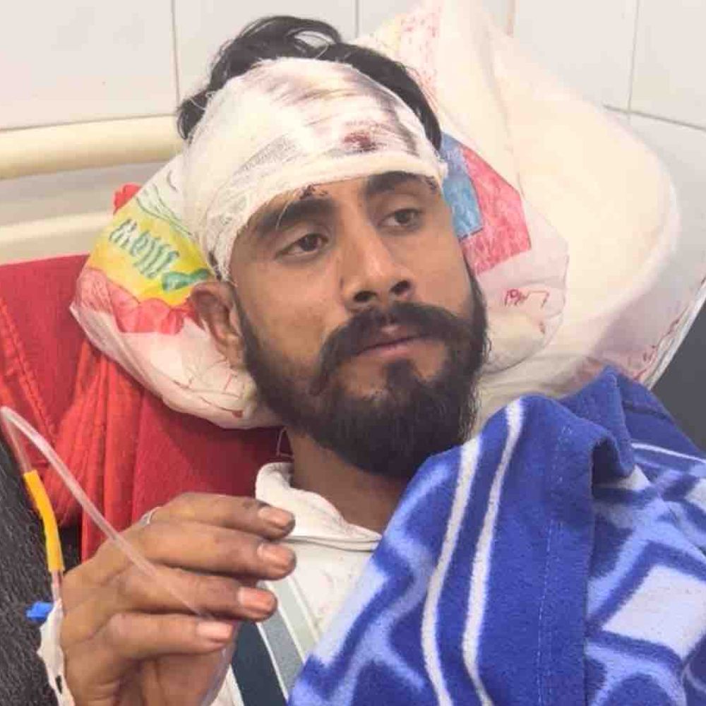 सिगरेट पीने से मना करने पर युवक पर हमला:दो युवकों ने रॉड मारकर सिर फोड़ा, गंभीर हालत में अस्पताल में भर्ती