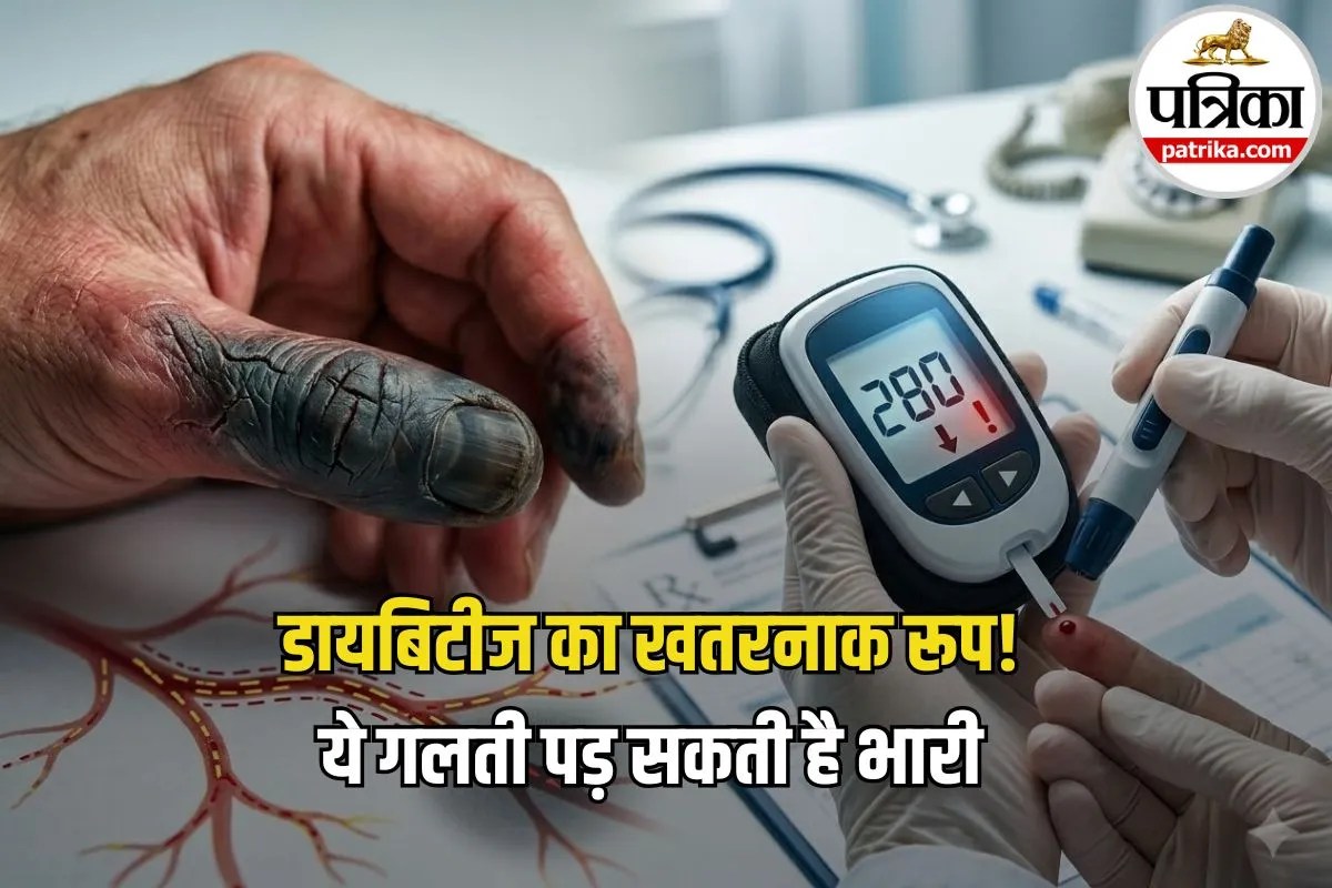 Gangrene Symptoms: डायबिटीज मरीजों के लिए अलर्ट! शरीर में ये लक्षण दिखें तो तुरंत हो जाएं सावधान, हो सकता है गैंगरीन