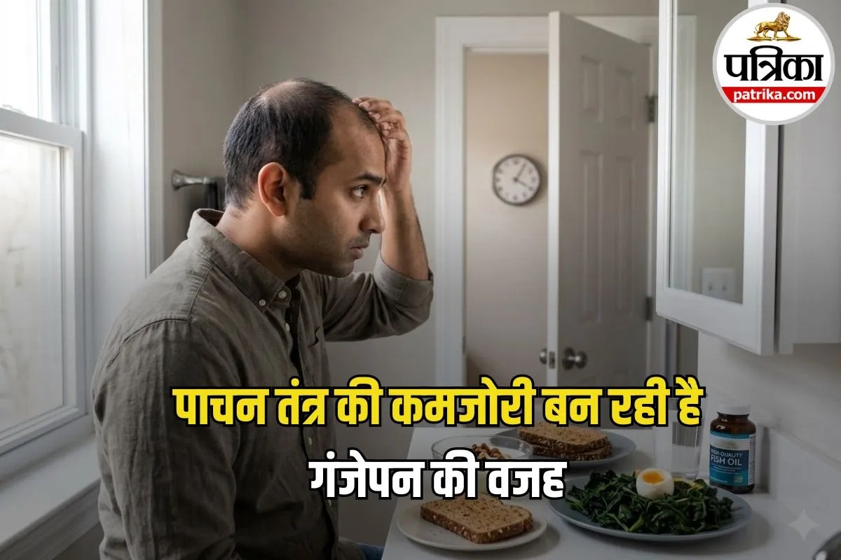 Hair Loss Alert: सिर्फ जेनेटिक्स नहीं, अब आपके पेट की खराबी भी उड़ा सकती है सिर के बाल, नई स्टडी में खुलासा