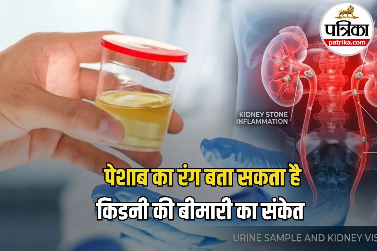 Kidney Disease Warning Signs: पेशाब का रंग बता सकता है किडनी की सेहत का हाल, जानिए कौन सा रंग देता है खतरे का संकेत